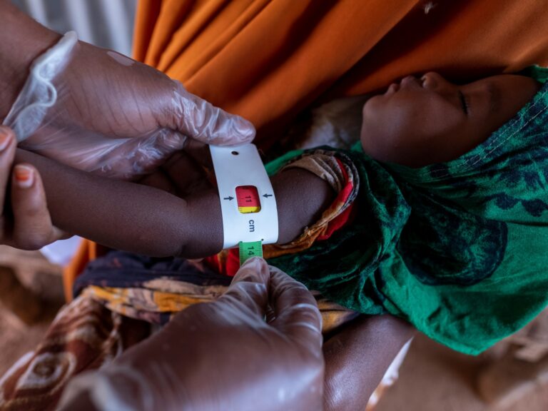 UN: Malnutrition in mothers soars in crisis-hit countries