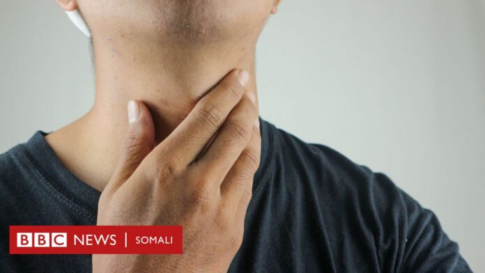 Wax ka ogow noocyada ugu badan kansarka ee ka jira Soomaaliya iyo sababaha loo maleynayo