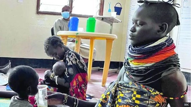 Starvation alert as children fill Kenya refugee ward after US aid cuts