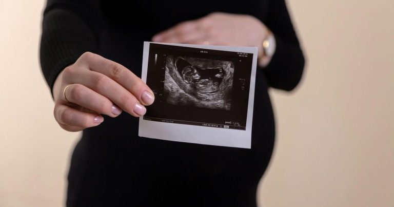 This app turns your smartphone into a fetal heart rate monitor